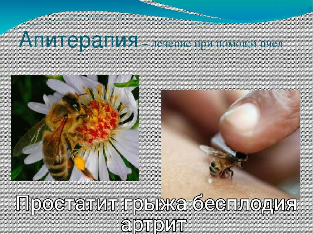 Чирчик: Sanatorium of power engineers